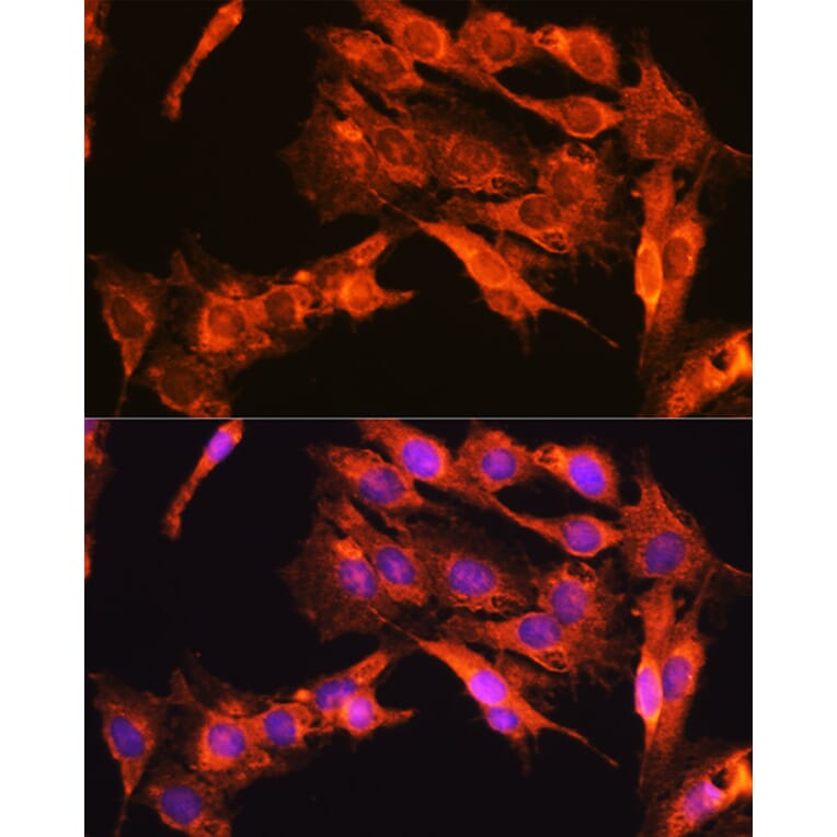 Immunofluorescence - Anti-TrkA + TrkB + TrkC Antibody (A306771) - Antibodies.com