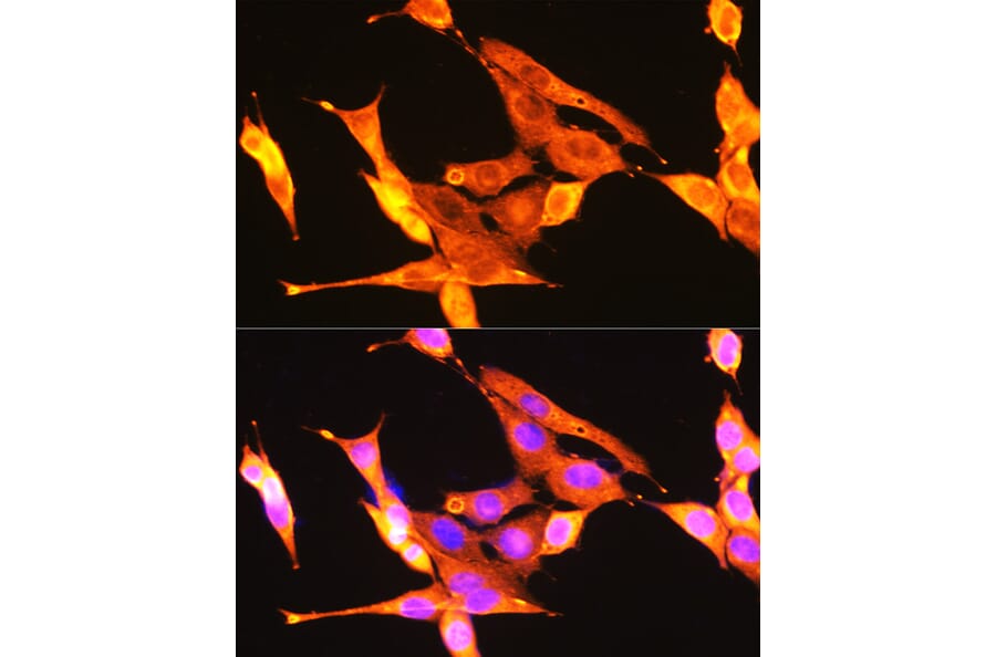 Immunofluorescence - Anti-TrkA + TrkB + TrkC Antibody (A306771) - Antibodies.com