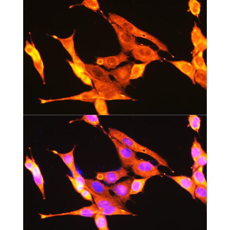 Immunofluorescence - Anti-TrkA + TrkB + TrkC Antibody (A306771) - Antibodies.com