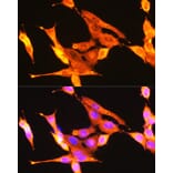 Immunofluorescence - Anti-TrkA + TrkB + TrkC Antibody (A306771) - Antibodies.com