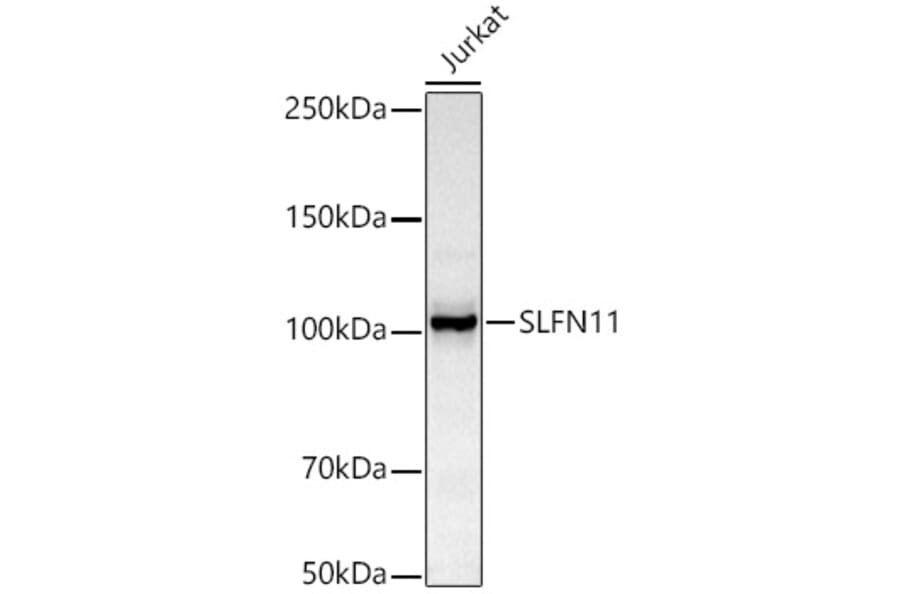 Western Blot - Anti-SLFN11 Antibody [ARC51651] (A306772) - Antibodies.com