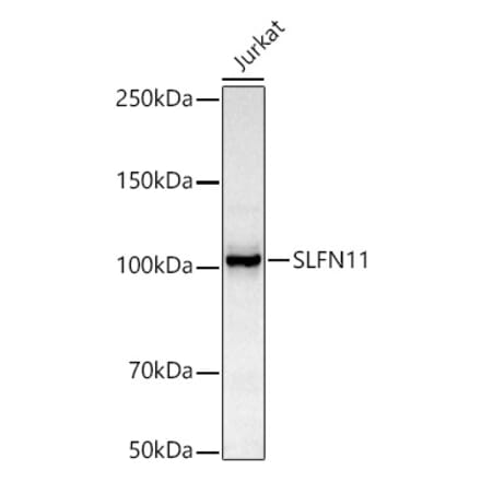 Western Blot - Anti-SLFN11 Antibody [ARC51651] (A306772) - Antibodies.com