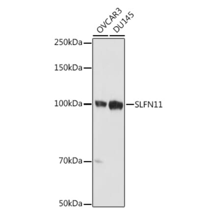 Western Blot - Anti-SLFN11 Antibody (A306773) - Antibodies.com