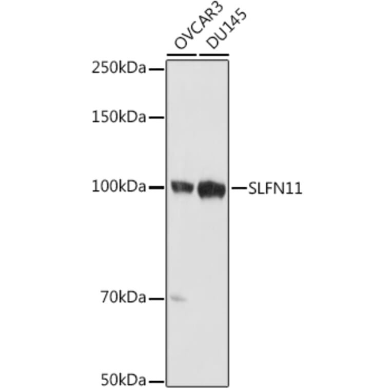 Western Blot - Anti-SLFN11 Antibody (A306773) - Antibodies.com