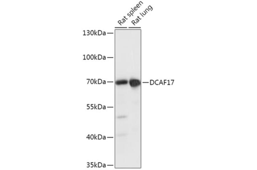 Western Blot - Anti-DCAF17 Antibody (A306774) - Antibodies.com