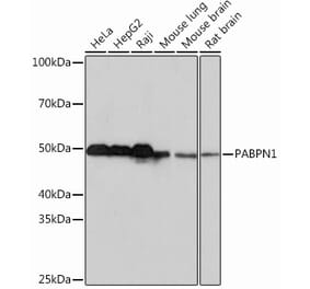 Western Blot - Anti-PABPN1 Antibody [ARC0730] (A306775) - Antibodies.com