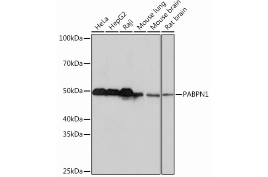 Western Blot - Anti-PABPN1 Antibody [ARC0730] (A306775) - Antibodies.com