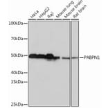 Western Blot - Anti-PABPN1 Antibody [ARC0730] (A306775) - Antibodies.com