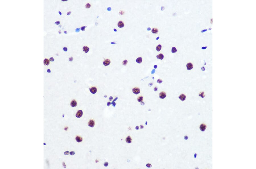 Immunohistochemistry - Anti-PABPN1 Antibody [ARC0730] (A306775) - Antibodies.com