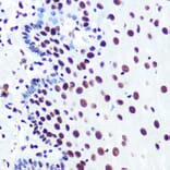 Immunohistochemistry - Anti-PABPN1 Antibody [ARC0730] (A306775) - Antibodies.com