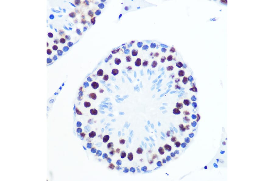 Immunohistochemistry - Anti-PABPN1 Antibody [ARC0730] (A306775) - Antibodies.com