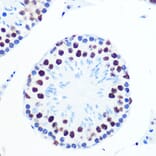 Immunohistochemistry - Anti-PABPN1 Antibody [ARC0730] (A306775) - Antibodies.com