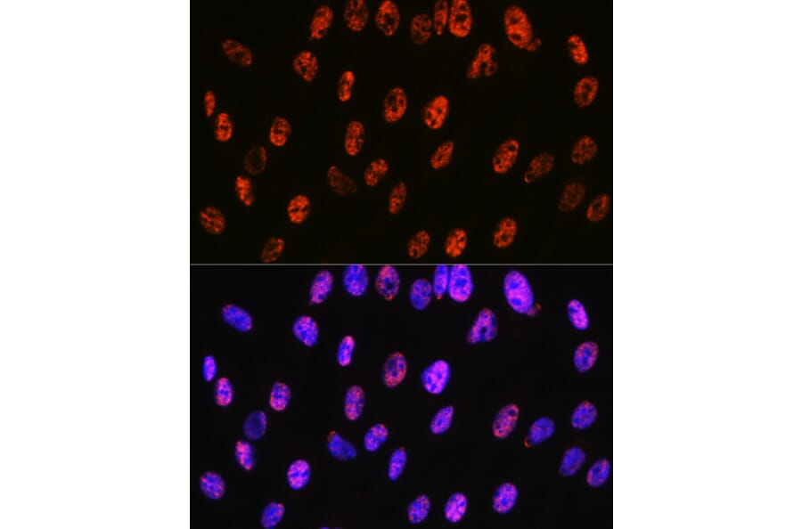 Immunofluorescence - Anti-PABPN1 Antibody [ARC0730] (A306775) - Antibodies.com
