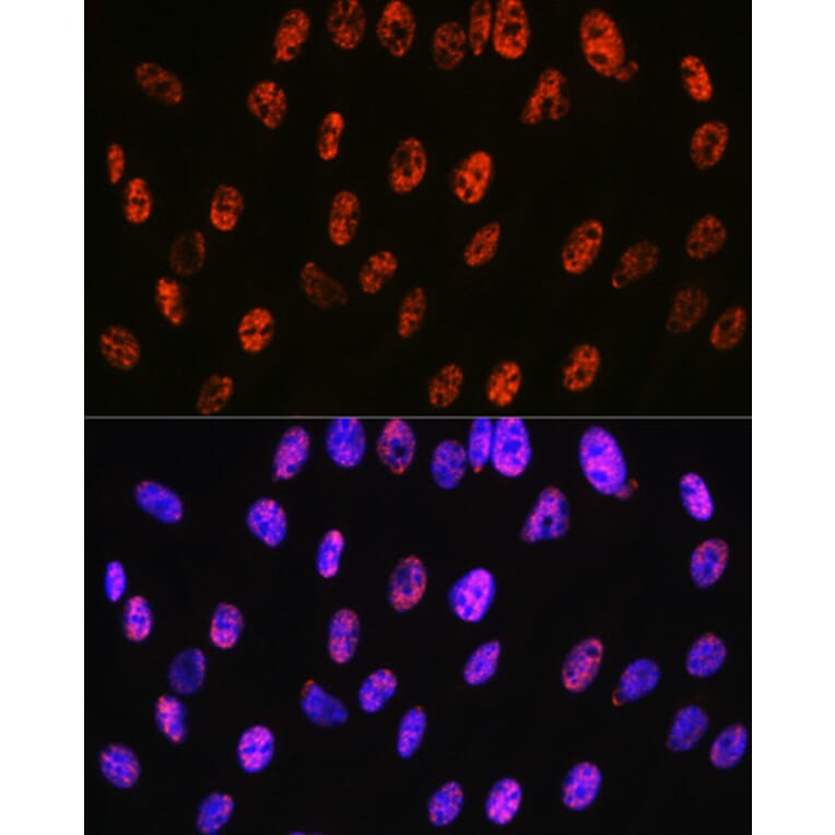 Immunofluorescence - Anti-PABPN1 Antibody [ARC0730] (A306775) - Antibodies.com