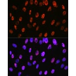 Immunofluorescence - Anti-PABPN1 Antibody [ARC0730] (A306775) - Antibodies.com