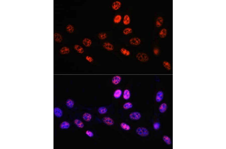 Immunofluorescence - Anti-PABPN1 Antibody [ARC0730] (A306775) - Antibodies.com