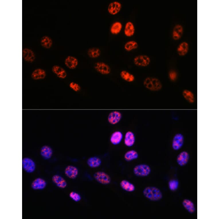 Immunofluorescence - Anti-PABPN1 Antibody [ARC0730] (A306775) - Antibodies.com