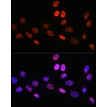 Immunofluorescence - Anti-PABPN1 Antibody [ARC0730] (A306775) - Antibodies.com