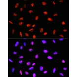 Immunofluorescence - Anti-PABPN1 Antibody [ARC0730] (A306775) - Antibodies.com