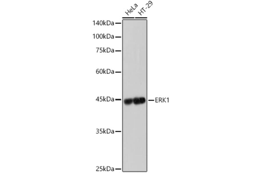 Western Blot - Anti-ERK1 Antibody [ARC2591] (A306776) - Antibodies.com