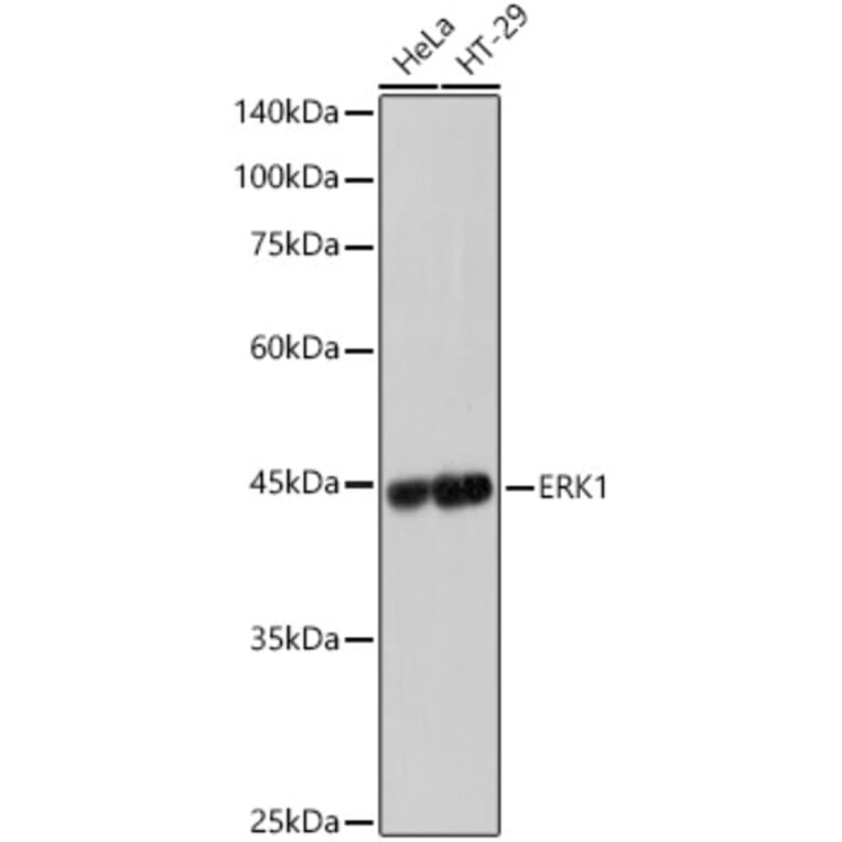 Western Blot - Anti-ERK1 Antibody [ARC2591] (A306776) - Antibodies.com