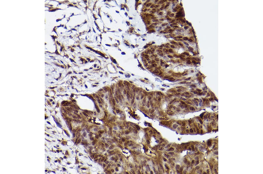 Immunohistochemistry - Anti-ERK1 Antibody [ARC2591] (A306776) - Antibodies.com