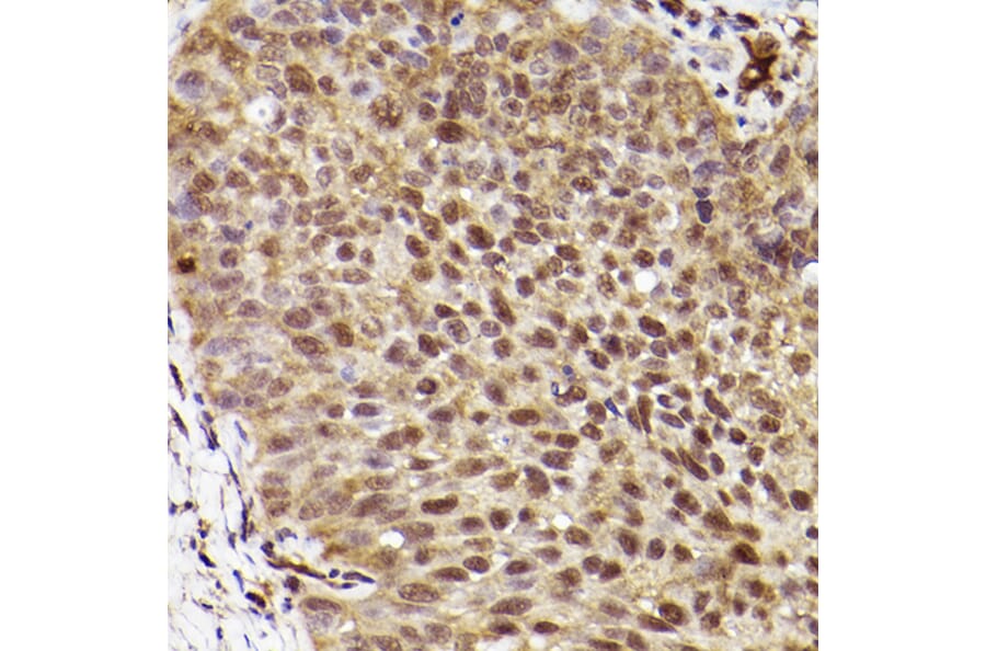 Immunohistochemistry - Anti-ERK1 Antibody [ARC2591] (A306776) - Antibodies.com