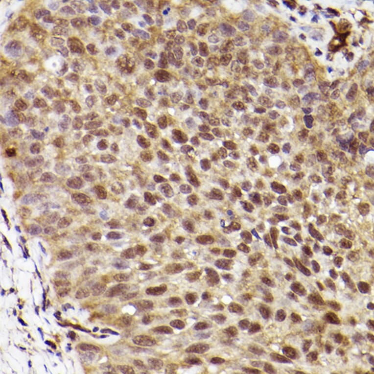 Immunohistochemistry - Anti-ERK1 Antibody [ARC2591] (A306776) - Antibodies.com