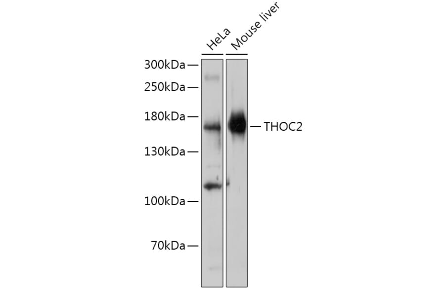 Western Blot - Anti-THOC2/Tho2 Antibody (A306777) - Antibodies.com