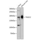 Western Blot - Anti-THOC2/Tho2 Antibody (A306777) - Antibodies.com