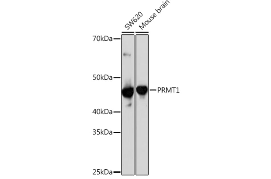 Western Blot - Anti-PRMT1 Antibody [ARC1066] (A306779) - Antibodies.com