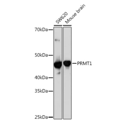 Western Blot - Anti-PRMT1 Antibody [ARC1066] (A306779) - Antibodies.com