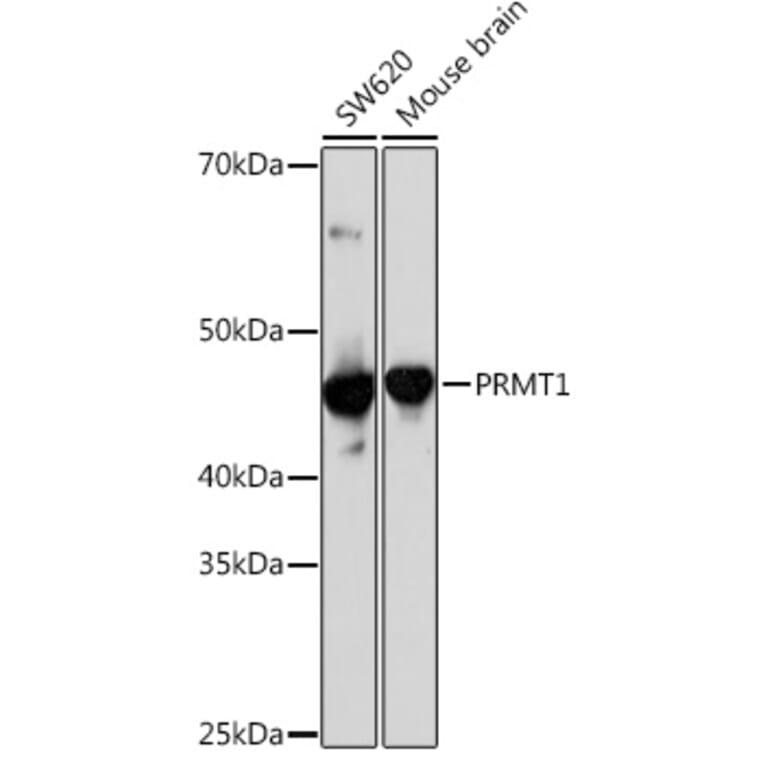 Western Blot - Anti-PRMT1 Antibody [ARC1066] (A306779) - Antibodies.com