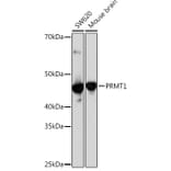 Western Blot - Anti-PRMT1 Antibody [ARC1066] (A306779) - Antibodies.com