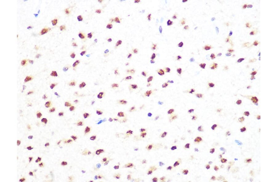 Immunohistochemistry - Anti-PRMT1 Antibody [ARC1066] (A306779) - Antibodies.com
