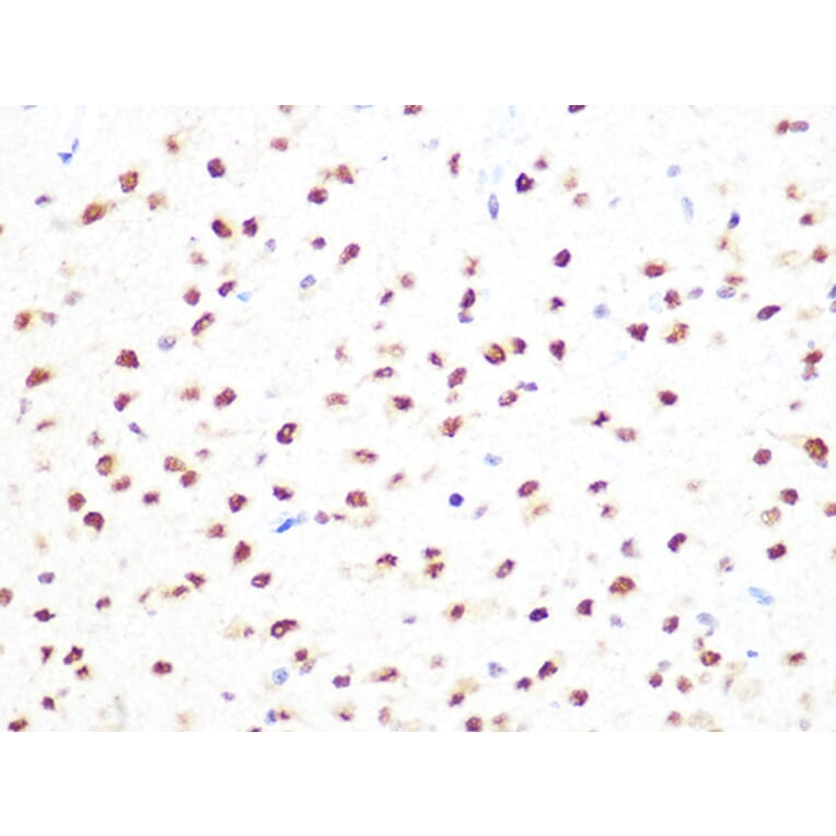 Immunohistochemistry - Anti-PRMT1 Antibody [ARC1066] (A306779) - Antibodies.com