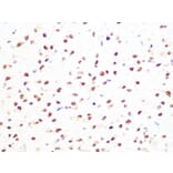 Immunohistochemistry - Anti-PRMT1 Antibody [ARC1066] (A306779) - Antibodies.com
