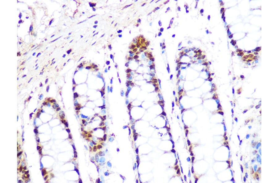 Immunohistochemistry - Anti-PRMT1 Antibody [ARC1066] (A306779) - Antibodies.com