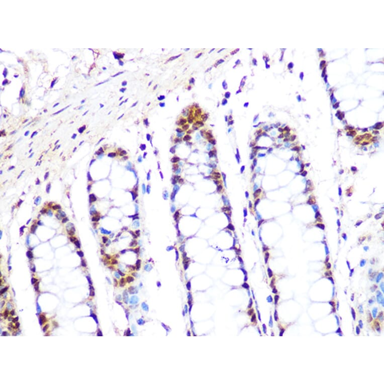 Immunohistochemistry - Anti-PRMT1 Antibody [ARC1066] (A306779) - Antibodies.com