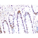 Immunohistochemistry - Anti-PRMT1 Antibody [ARC1066] (A306779) - Antibodies.com