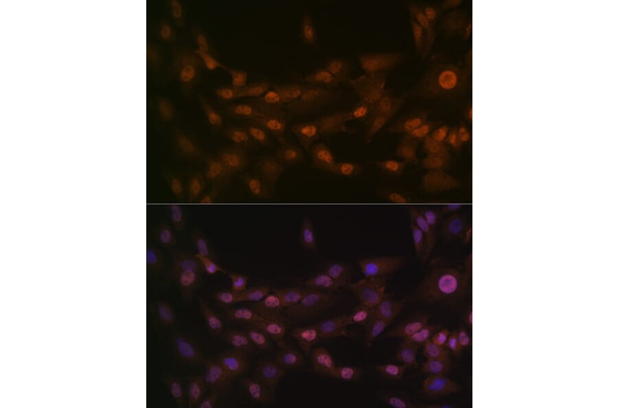 Immunofluorescence - Anti-PRMT1 Antibody [ARC1066] (A306779) - Antibodies.com