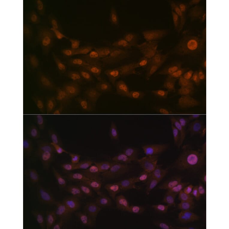 Immunofluorescence - Anti-PRMT1 Antibody [ARC1066] (A306779) - Antibodies.com