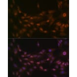 Immunofluorescence - Anti-PRMT1 Antibody [ARC1066] (A306779) - Antibodies.com