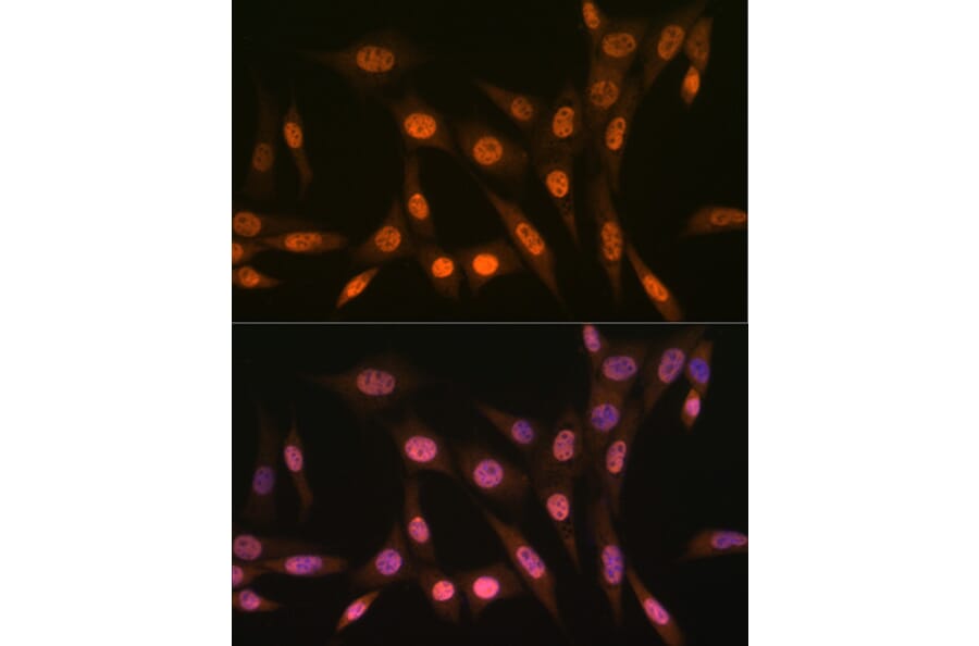 Immunofluorescence - Anti-PRMT1 Antibody [ARC1066] (A306779) - Antibodies.com
