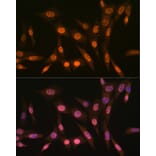Immunofluorescence - Anti-PRMT1 Antibody [ARC1066] (A306779) - Antibodies.com