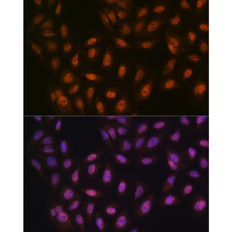 Immunofluorescence - Anti-PRMT1 Antibody [ARC1066] (A306779) - Antibodies.com