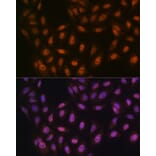 Immunofluorescence - Anti-PRMT1 Antibody [ARC1066] (A306779) - Antibodies.com