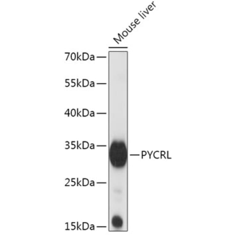 Western Blot - Anti-PYCRL Antibody (A306781) - Antibodies.com