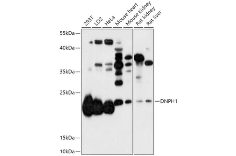 Western Blot - Anti-RCL Antibody (A306783) - Antibodies.com