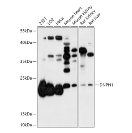 Western Blot - Anti-RCL Antibody (A306783) - Antibodies.com